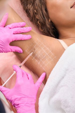 Θεραπεία Υπερδρωσίας - Botox