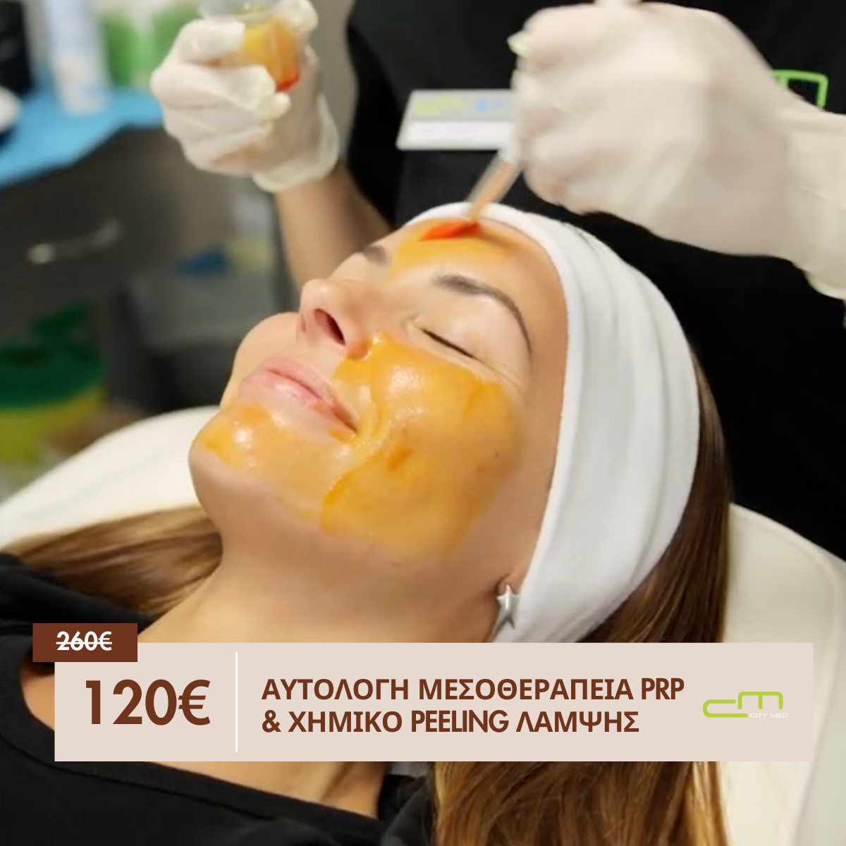 Αυτόλογη Μεσοθεραπεία PRP & Χημικό Peeling Λάμψης 120€